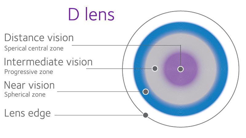 D Lens and N Lens