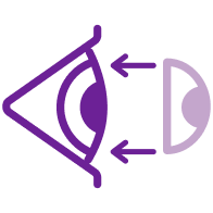 Illustration of how the lens is placed on the eye.