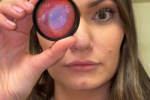 cropped photo of optometry school student blair coffman golightly holding a loose, colored trial lens in front of her eye