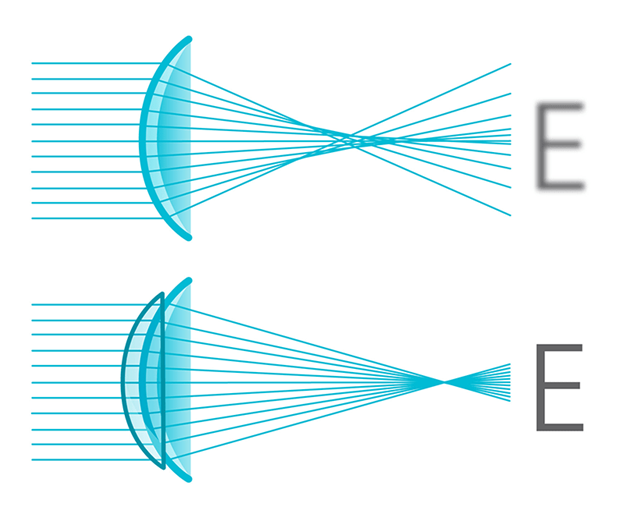 Aberration Neutralizing System™ | CooperVision