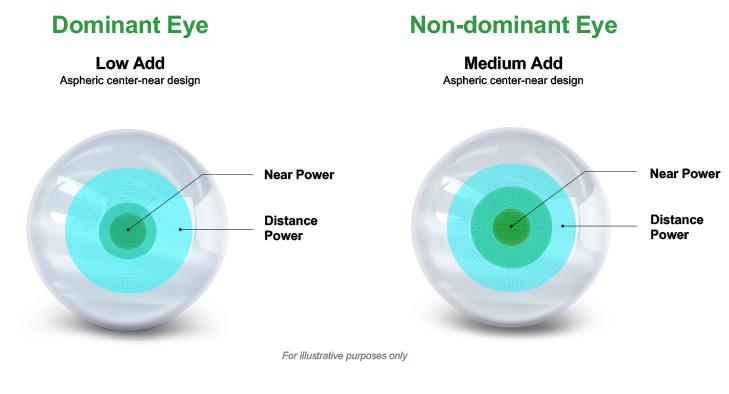 MyDay® family - Contact Lens - Multifocal - Advancing Presbyopes
