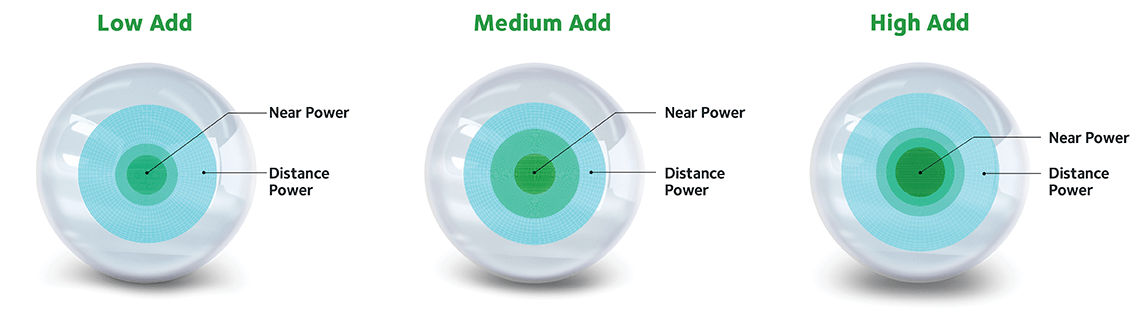 Graphic of CooperVision Binocular Progressive System™ and its innovative technology that provides great vision up close, far away, and in between, for all levels of presbyopia.1