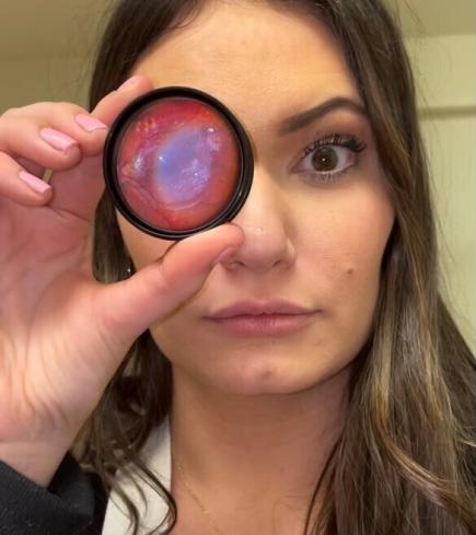 Optometry student Blair Golightly Coffman holding a loose, colored trial lens in front of her eye.