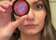 cropped photo of optometry school student blair coffman golightly holding a loose, colored trial lens in front of her eye
